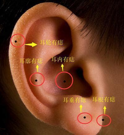 耳根痣|耳朵长痣的位置图解 耳朵长痣的位置图解有福气